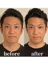 ロータス ビューティー(LOTUS Beauty)/小顔/目の開き