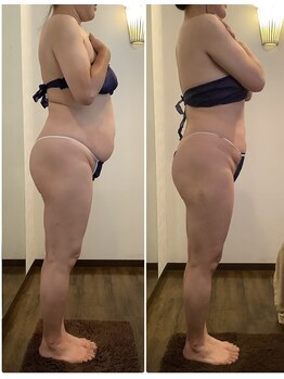 エステティックジュネス(JEUNESSE)/シークレットボディ