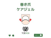 エヌ(N)/巻き爪ケア