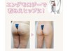 【気になる部分を徹底ケア】最先端痩身機器でスリムボディへ/アライアンス