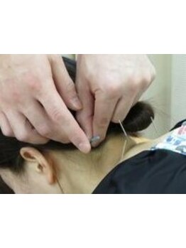 眼精疲労を解消したい