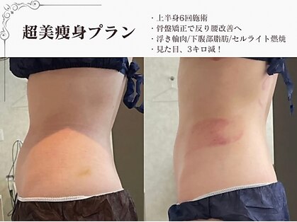 ラブミー 渋谷本店(LoveMe)の写真