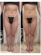 ありひ/セルゼロ効果！！