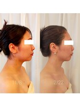 ミールーム(mi room)/ブライダルエステ３ヶ月半