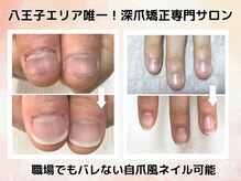 エルナの雰囲気（症例実績５万件以上の八王子エリア初のリプロネイル登録店！）
