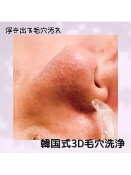 シャイン(Shine)の写真/【メンズ】だって気になる毛穴汚れ！長年の悩みが解決/清潔感ある肌は好感度UP！メンズ韓国式3D毛穴洗浄
