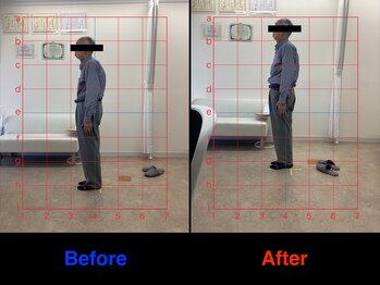 仁 久喜院(JIN)/#歩き方#足の裏#足底の痛み#足裏