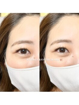 リノ(Lino)/コスメリフト♪