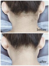 エタニティ 西宮店(Eternity)/人気メニュー！うなじ、背中ケア