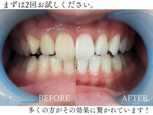 フレスコ レディース 刈谷店(FRESCO)