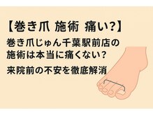 巻き爪じゅん 千葉駅前店/施術は本当につらくない？
