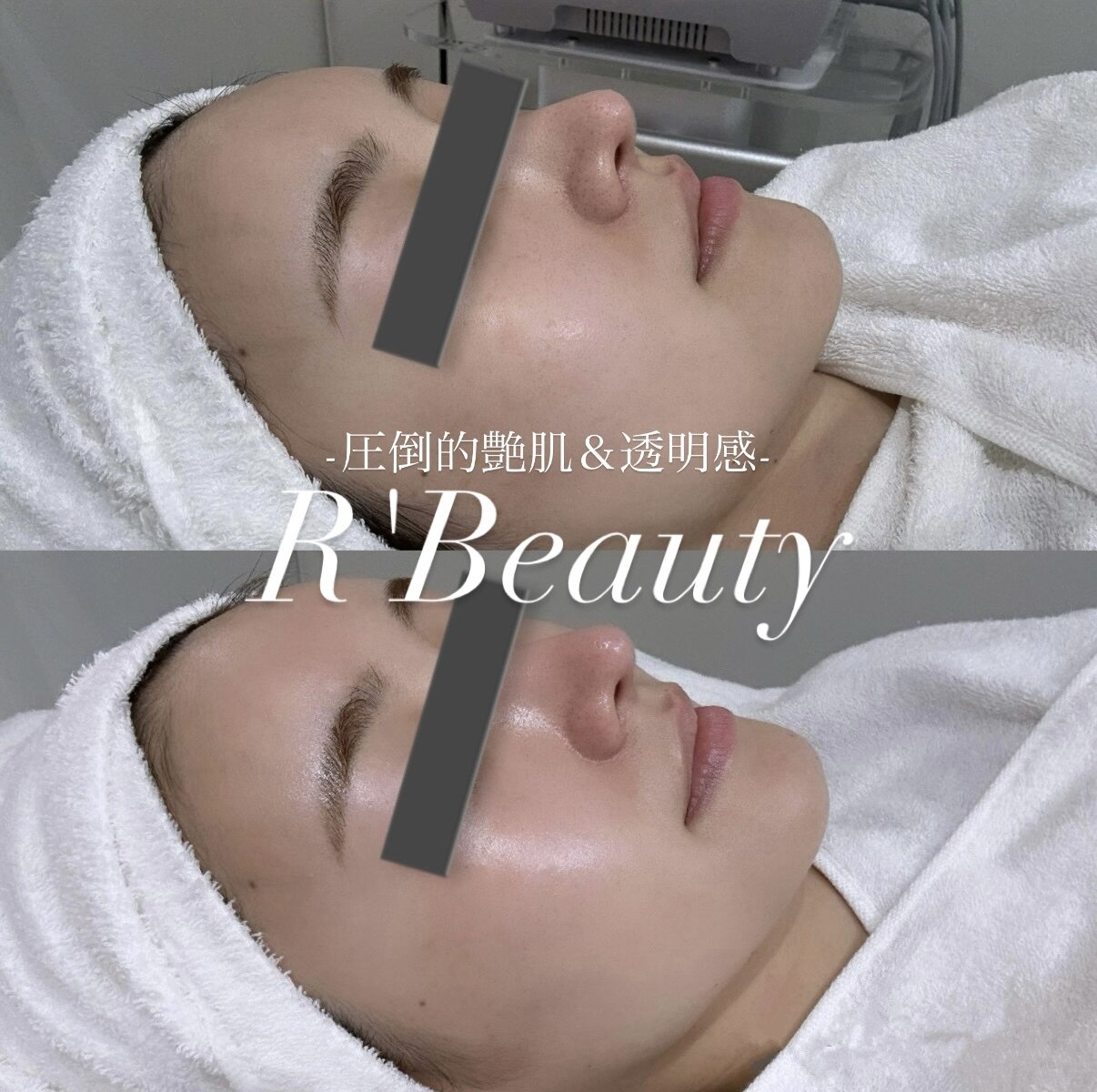 アールビューティー 東新宿店(R'Beauty)｜ホットペッパービューティー