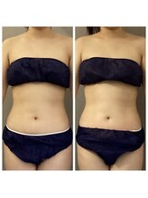 リノレア(Lino_Lea)/【お腹中心コース】