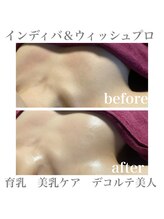 プラチナローズ(Platinum Rose)/育乳、美乳、デコルテ美人