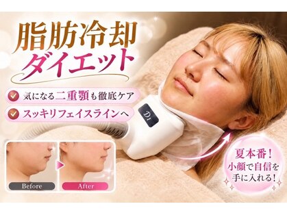 アイスタイル(i-style)の写真