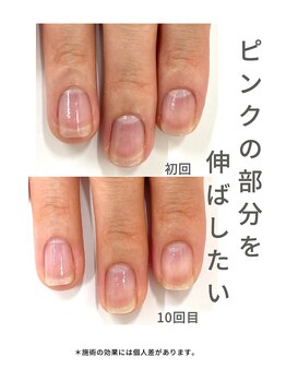 最強ネイルケア