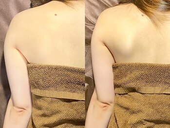 ルーナジェーナ(Luna llena)/池袋 エステ ルーナジェーナ