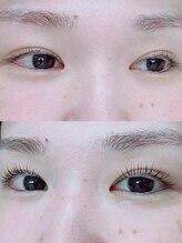 イチマルニ(102)/