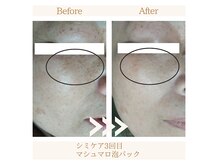 ファミル(FAMIL)の雰囲気（たった数回でこの効果！！）
