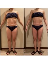 エステティック レイビス 青森店(RAYVIS)/全身痩せも部位痩せも♪