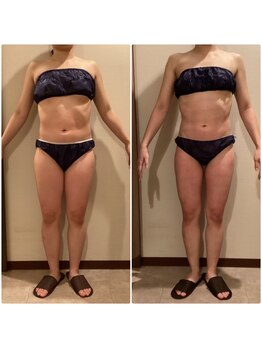 エステティック レイビス 青森店(RAYVIS)/全身痩せも部位痩せも♪