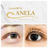 アネラ(ANELA)