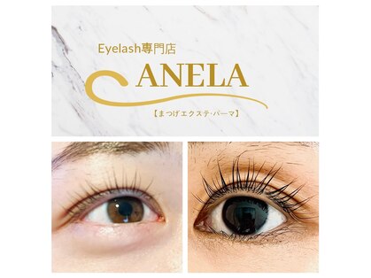 アネラ(ANELA)の写真