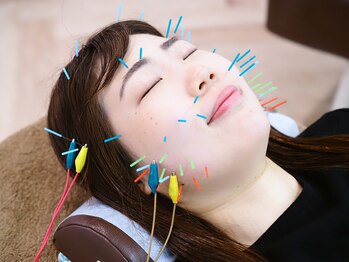 ウル鍼灸整骨院/美容鍼♪