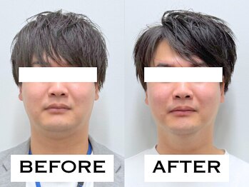 ビハリスト 新宿マルイ本館/むくみがとれて輪郭がすっきり!