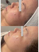 みるん(milne.)/シワたるみお悩みの方にオススメ