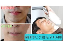 マルヤマサロン(MARUYAMA SALON)の雰囲気（【人気のひげ脱毛】脱毛/ひげ/メンズ/男性/全身脱毛）