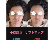 美容矯正サロン レレポノ(LELEPONO)/