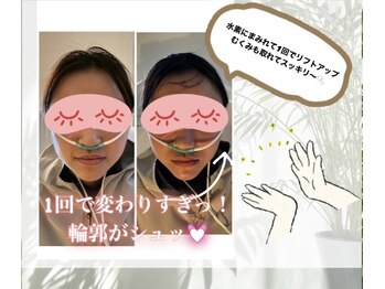 グロワール(gloire)/◇BeforeAfter◇