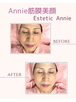 アニー(Annie)/Annie筋膜美顔のお客様☆