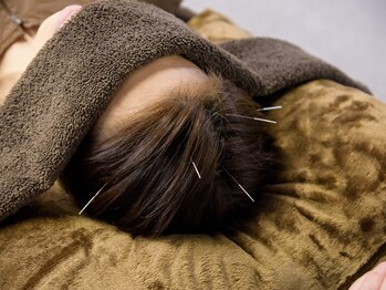 やぎおか堂/鍼灸