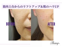 サンク(Thanq)/潤いのあるぱんっとしたハリを