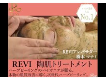 シロエルヴィ(SILOE)