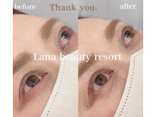 ラナビューティリゾート(Lana Beauty resort)/アップラッシュリフト