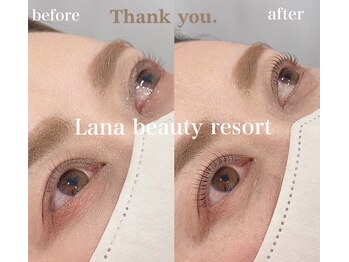 ラナビューティリゾート(Lana Beauty resort)/アップラッシュリフト
