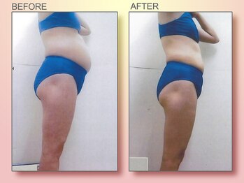 ジュリア オージェ 四条河原町店/ ビフォーアフター（エンダ)