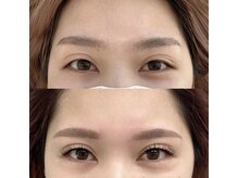 スリール(sourire)/＆Healthy×フラット120本×EB