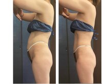 ビテュセスリー はなみずき店(美tusais3)/【美尻・美脚】ヒップアップ