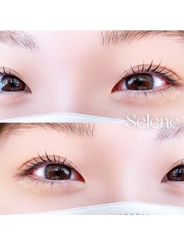 セレネ(Selene)/ラッシュリフト
