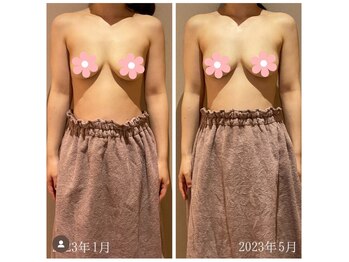 オクノマ(OKUNOMA)/【お客様BeforeAfter】