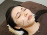 【夏本番を迎える前に小顔、美肌に♪】全身整体+美容鍼60分14000円→11000円