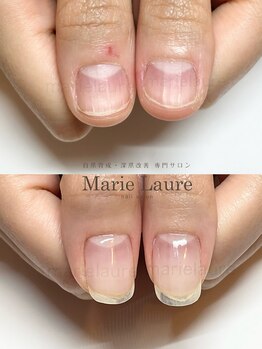 マリーロール 天王寺店(Marie Laure)/深爪矯正/自爪育成/ネイルケア