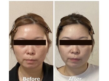 小顔22 ボルティ 本店(Bolty)/小顔シンメトリー矯正&全身矯正