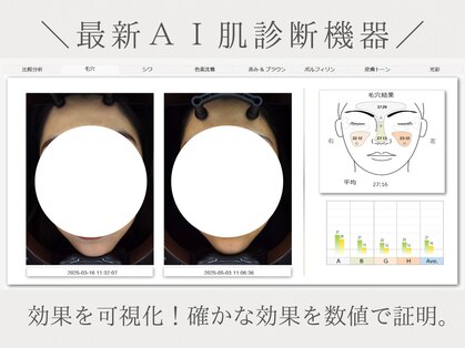 韓国肌管理室 ソア(soa)の写真
