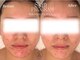 アールエーサロン(Ra salon)の写真