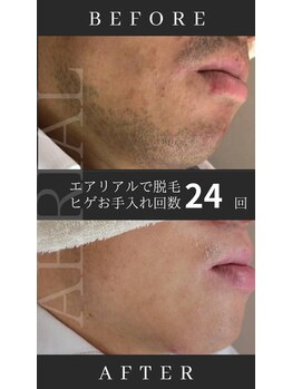 エアリアル 南行橋店/短い回数で効果実感！